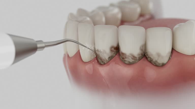 Reliable Dental Implants contractor in Denton, MD by Smile Center Dentistry